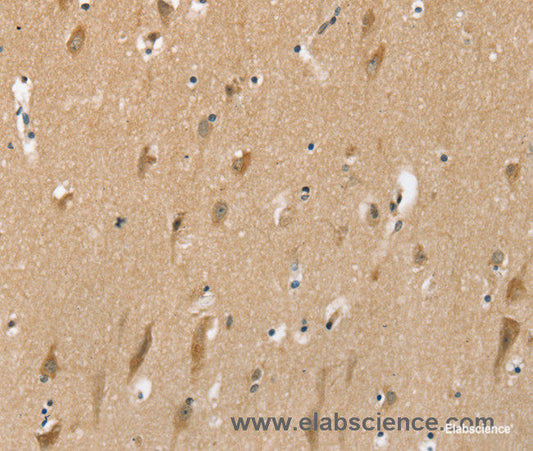 Immunohistochemistry of paraffin-embedded Human brain tissue using SLC6A7 Polyclonal Antibody at dilution 1:30