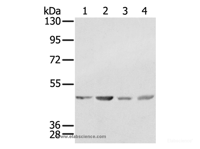 Western Blot analysis of K562, 231, Raji and hela  cell using SSB Polyclonal Antibody at dilution of 1:400