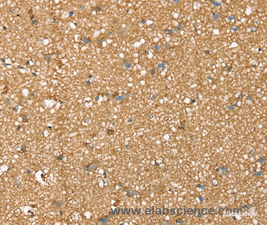 Immunohistochemistry of paraffin-embedded Human brain tissue using SDC3 Polyclonal Antibody at dilution 1:45