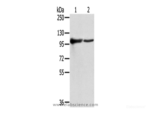Western Blot analysis of K562 and A431 cells using TPX2 Polyclonal Antibody at dilution of 1/800