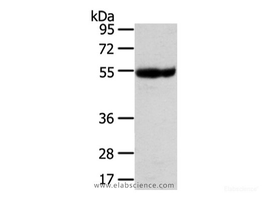 Western Blot analysis of Human placenta tissue using UBAP1 Polyclonal Antibody at dilution of 1/400