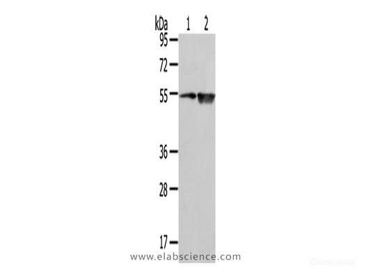 Western Blot analysis of TM4 cell and Human placenta tissue using EAAT3 Polyclonal Antibody at dilution of 1/500