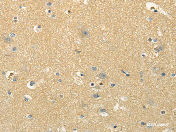 Immunohistochemistry of paraffin-embedded Human brain using MSI1 Polyclonal Antibody at dilution of  1/30