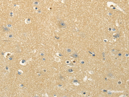Immunohistochemistry of paraffin-embedded Human brain using MSI1 Polyclonal Antibody at dilution of  1/30