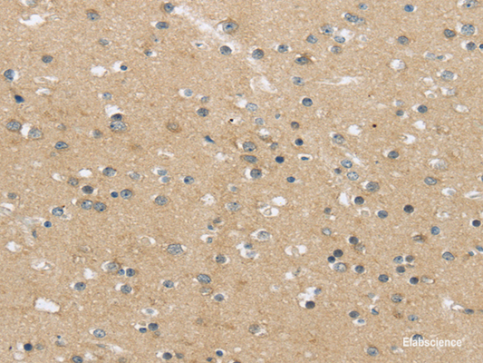 Immunohistochemistry of paraffin-embedded Human brain using MPP6 Polyclonal Antibody at dilution of  1/25