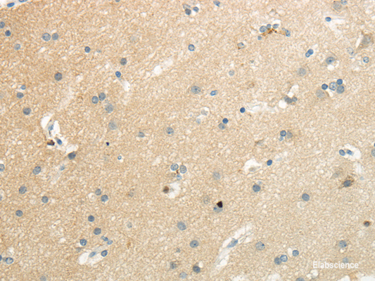 Immunohistochemistry of paraffin-embedded Human brain using SLC7A11 Polyclonal Antibody at dilution of  1/35