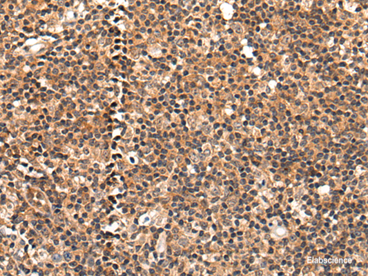Immunohistochemistry of paraffin-embedded Human tonsil tissue  using C16orf45 Polyclonal Antibody at dilution of 1:45(×200)