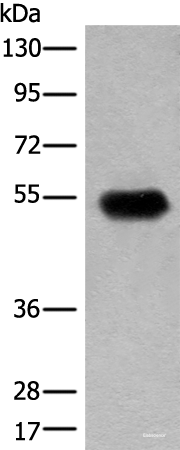 Western blot analysis of Human fetal brain tissue lysate  using CDT1 Polyclonal Antibody at dilution of 1:400