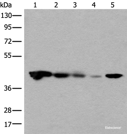 Western blot analysis of Jurkat HEPG2 and Hela cell Human testis tissue 231 cell lysates  using CECR5 Polyclonal Antibody at dilution of 1:650