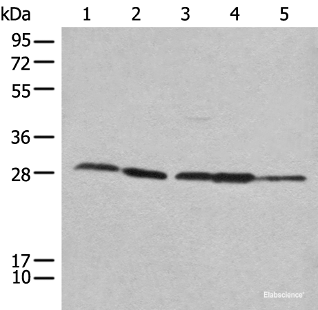 Western blot analysis of 293T Hela 231 HEPG2 and A431 cell lysates  using RPL14 Polyclonal Antibody at dilution of 1:800