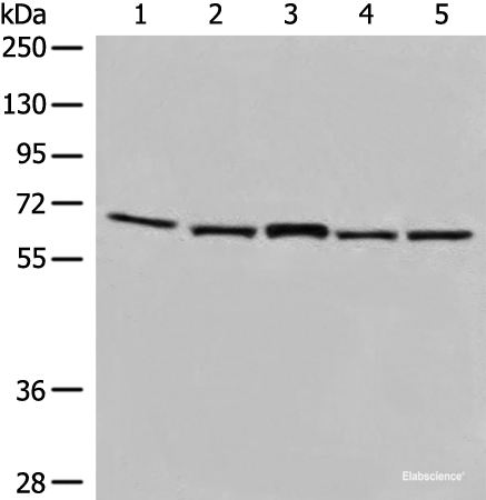 Western blot analysis of TM4 and 231 cell Mouse brain tissue Hela and HT-29 cell lysates  using EHD1 Polyclonal Antibody at dilution of 1:500