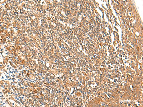 Immunohistochemistry of paraffin-embedded Human tonsil tissue  using TSHB Polyclonal Antibody at dilution of 1:40(×200)
