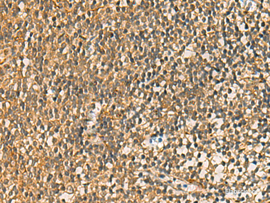 Immunohistochemistry of paraffin-embedded Human tonsil tissue  using FAAP100 Polyclonal Antibody at dilution of 1:50(×200)
