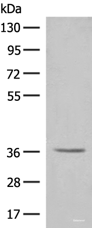 Western blot analysis of HT-29 cell lysate  using LGALS4 Polyclonal Antibody at dilution of 1:300