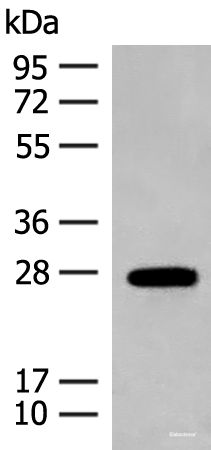 Western blot analysis of Mouse eye tissue lysate  using GUCA1B Polyclonal Antibody at dilution of 1:500