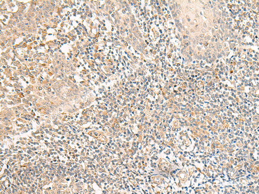 Immunohistochemistry of paraffin-embedded Human tonsil tissue  using GPR157 Polyclonal Antibody at dilution of 1:50(×200)