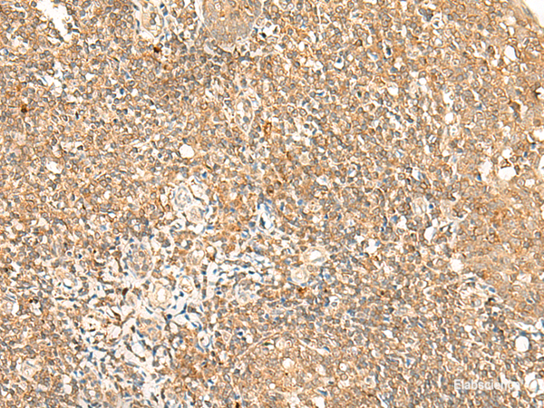 Immunohistochemistry of paraffin-embedded Human tonsil tissue  using GPR89A/GPR89B Polyclonal Antibody at dilution of 1:25(×200)