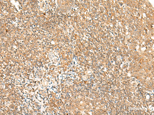 Immunohistochemistry of paraffin-embedded Human tonsil tissue  using GPR89A/GPR89B Polyclonal Antibody at dilution of 1:25(×200)