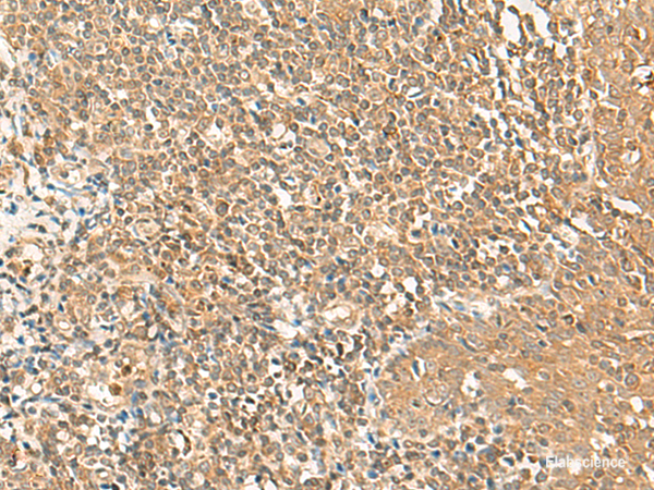Immunohistochemistry of paraffin-embedded Human tonsil tissue  using GRIPAP1 Polyclonal Antibody at dilution of 1:50(×200)