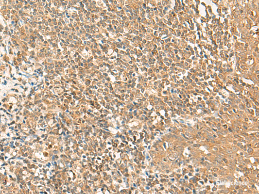Immunohistochemistry of paraffin-embedded Human tonsil tissue  using GRIPAP1 Polyclonal Antibody at dilution of 1:50(×200)