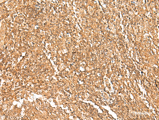 Immunohistochemistry of paraffin-embedded Human tonsil tissue  using GTF3A Polyclonal Antibody at dilution of 1:75(×200)