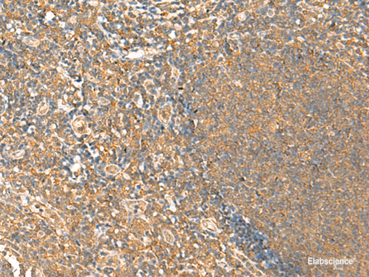 Immunohistochemistry of paraffin-embedded Human tonsil tissue  using HTT Polyclonal Antibody at dilution of 1:25(×200)