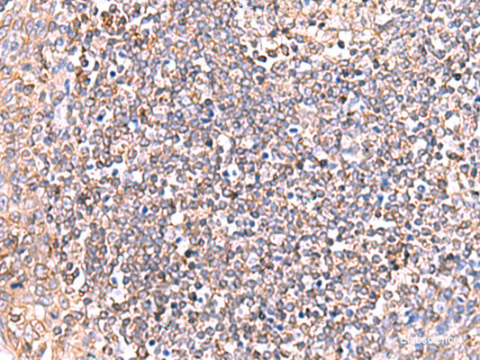 Immunohistochemistry of paraffin-embedded Human tonsil tissue  using GRIA2 Polyclonal Antibody at dilution of 1:50(×200)