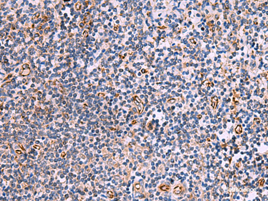 Immunohistochemistry of paraffin-embedded Human tonsil tissue  using ITGA11 Polyclonal Antibody at dilution of 1:75(×200)