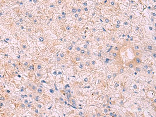 Immunohistochemistry of paraffin-embedded Human tonsil tissue  using KANSL1L Polyclonal Antibody at dilution of 1:40(×200)
