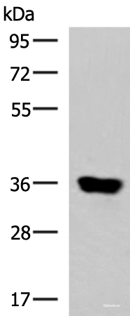 Western blot analysis of Human muscle tissue lysate  using KCNK15 Polyclonal Antibody at dilution of 1:1000
