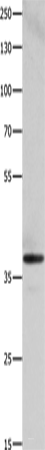 Western blot analysis of HepG2 cells  using HMOX2 Polyclonal Antibody at dilution of 1:500