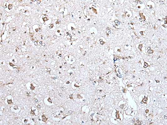 Immunohistochemistry of paraffin-embedded Human brain tissue  using MCM10 Polyclonal Antibody at dilution of 1:45(×200)