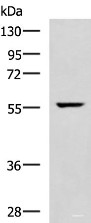 Western blot analysis of Mouse heart tissue lysate  using TRAF6 Polyclonal Antibody at dilution of 1:300