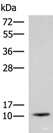 Western blot analysis of Human fetal brain tissue lysate  using ACYP1 Polyclonal Antibody at dilution of 1:700