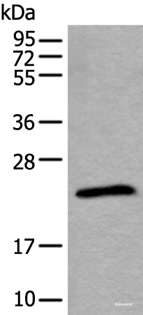 Western blot analysis of Jurkat cell lysate  using TPT1 Polyclonal Antibody at dilution of 1:800