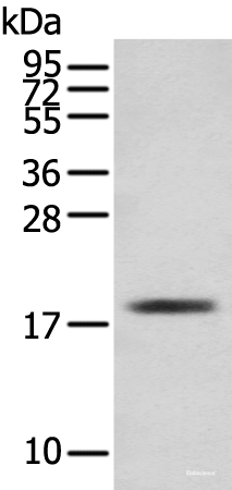Western blot analysis of Mouse skeletal muscle tissue  using TNNC1 Polyclonal Antibody at dilution of 1:250