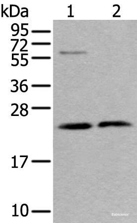 Western blot analysis of LO2 cell and Human testis tissue lysates  using ABHD14B Polyclonal Antibody at dilution of 1:350