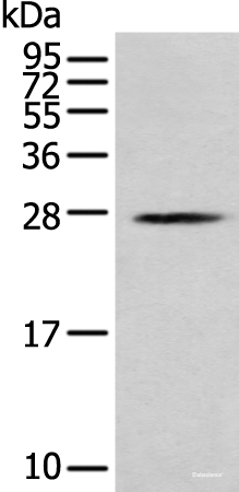 Western blot analysis of K562 cell  using MOB1B Polyclonal Antibody at dilution of 1:250