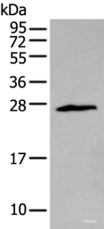 Western blot analysis of Jurkat cell  using ZNF22 Polyclonal Antibody at dilution of 1:400
