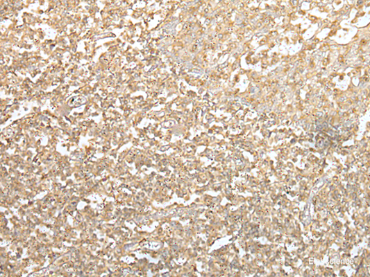 Immunohistochemistry of paraffin-embedded Human tonsil tissue  using SPIC Polyclonal Antibody at dilution of 1:55(×200)