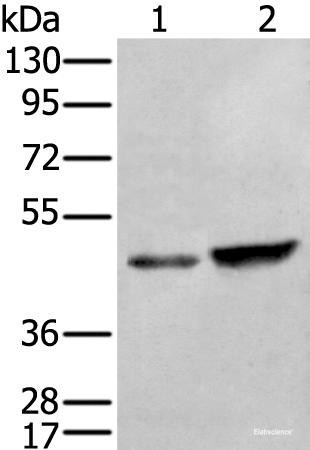 Western blot analysis of HUVEC and Hela cell lysates  using ZNF24 Polyclonal Antibody at dilution of 1:350