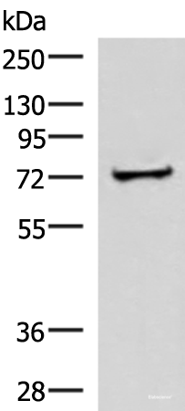Western blot analysis of Human liver tissue lysate  using ZNF263 Polyclonal Antibody at dilution of 1:500