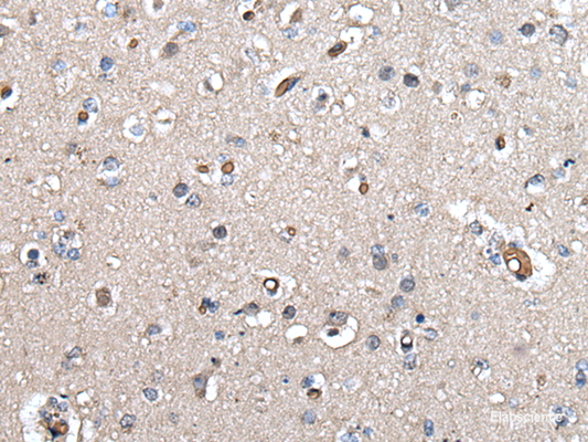 Immunohistochemistry of paraffin-embedded Human brain tissue  using UMPS Polyclonal Antibody at dilution of 1:40(×200)