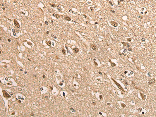 Immunohistochemistry of paraffin-embedded Human brain tissue  using BATF Polyclonal Antibody at dilution of 1:45(×200)