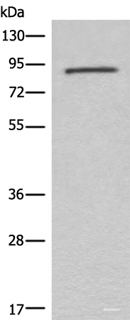 Western blot analysis of Mouse lung tissue lysate  using C7 Polyclonal Antibody at dilution of 1:800