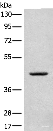 Western blot analysis of A375 cell lysate  using CANT1 Polyclonal Antibody at dilution of 1:500