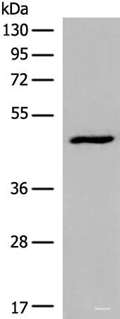 Western blot analysis of HL-60 cell lysate  using DCP2 Polyclonal Antibody at dilution of 1:500