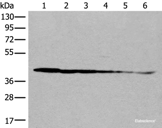 Western blot analysis of Rat brain tissue Human cerebrum tissue Human fetal brain tissue Hela cell Human breast cancer tissue Jurkat cell lysates  using PITPNB Polyclonal Antibody at dilution of 1:500