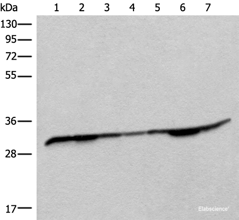 Western blot analysis of Rat heart tissue Mouse heart tissue Rat brain tissue Mouse brain tissue HEPG2 cell Jurkat and Lovo cell lysates  using RSU1 Polyclonal Antibody at dilution of 1:400