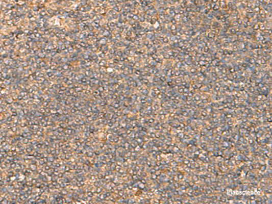Immunohistochemistry of paraffin-embedded Human tonsil tissue  using DNAJC14 Polyclonal Antibody at dilution of 1:55(×200)